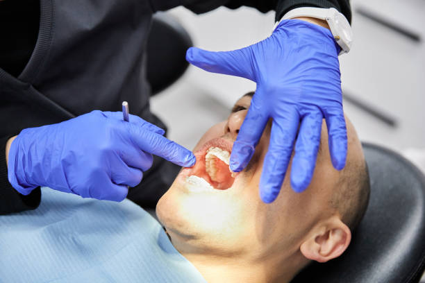 Best Dentist for Tooth Abscess  in East Dublin, GA