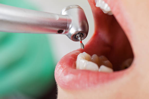 Best Knocked-Out Tooth Emergency  in East Dublin, GA
